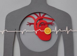 Triglicéridos altos: cuál es la dieta recomendada por los expertos para controlarlos