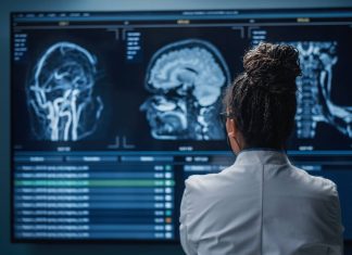 Consiguen por primera vez deshacer las placas del alzhéimer. ¿Y ahora?