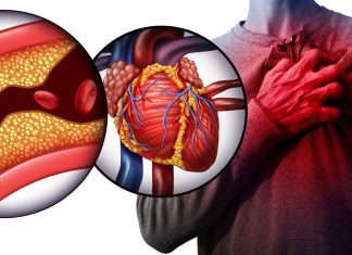 11 alimentos que ayudan a reducir el colesterol, según los especialistas de Harvard