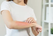 Piel bajo la lupa: siete señales que podrían advertir problemas de salud