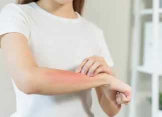 Piel bajo la lupa: siete señales que podrían advertir problemas de salud