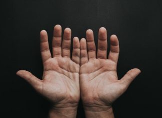 Este signo en tus manos podría revelar que tienes el colesterol alto, según los médicos