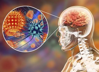 «Es muy grave»: qué es la meningitis, la enfermedad por la que Minsal levantó alerta