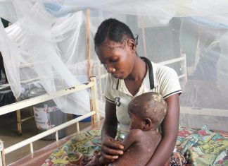 ONU solicitó 18,5 millones de dólares para contener brote de viruela del mono en África