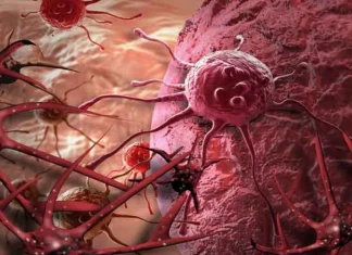 El mapa global del cáncer: cuáles son los tumores que más muertes causan en el mundo