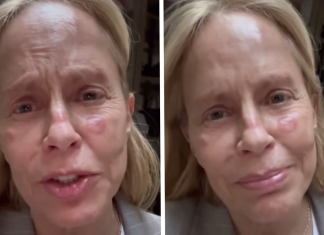 Cecilia Bolocco se baja de la Teletón tras sufrir preocupante inconveniente médico: impactó con registro de sus lesiones