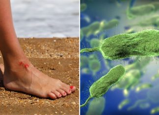 Preocupación en Estados Unidos por alza histórica de la bacteria “comecarne”